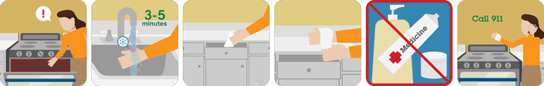 pictograph sequence showing how to treat a burn